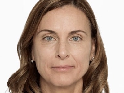 Sculptra Facial After