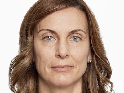 Sculptra Facial Before
